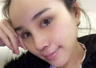 第一章帮嫂子消消肿好吗,巧用秘方，帮嫂子轻松消消肿